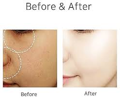Rose & Salmon (Proteoglycan) Hydro Balancing Serum 50ml image 2